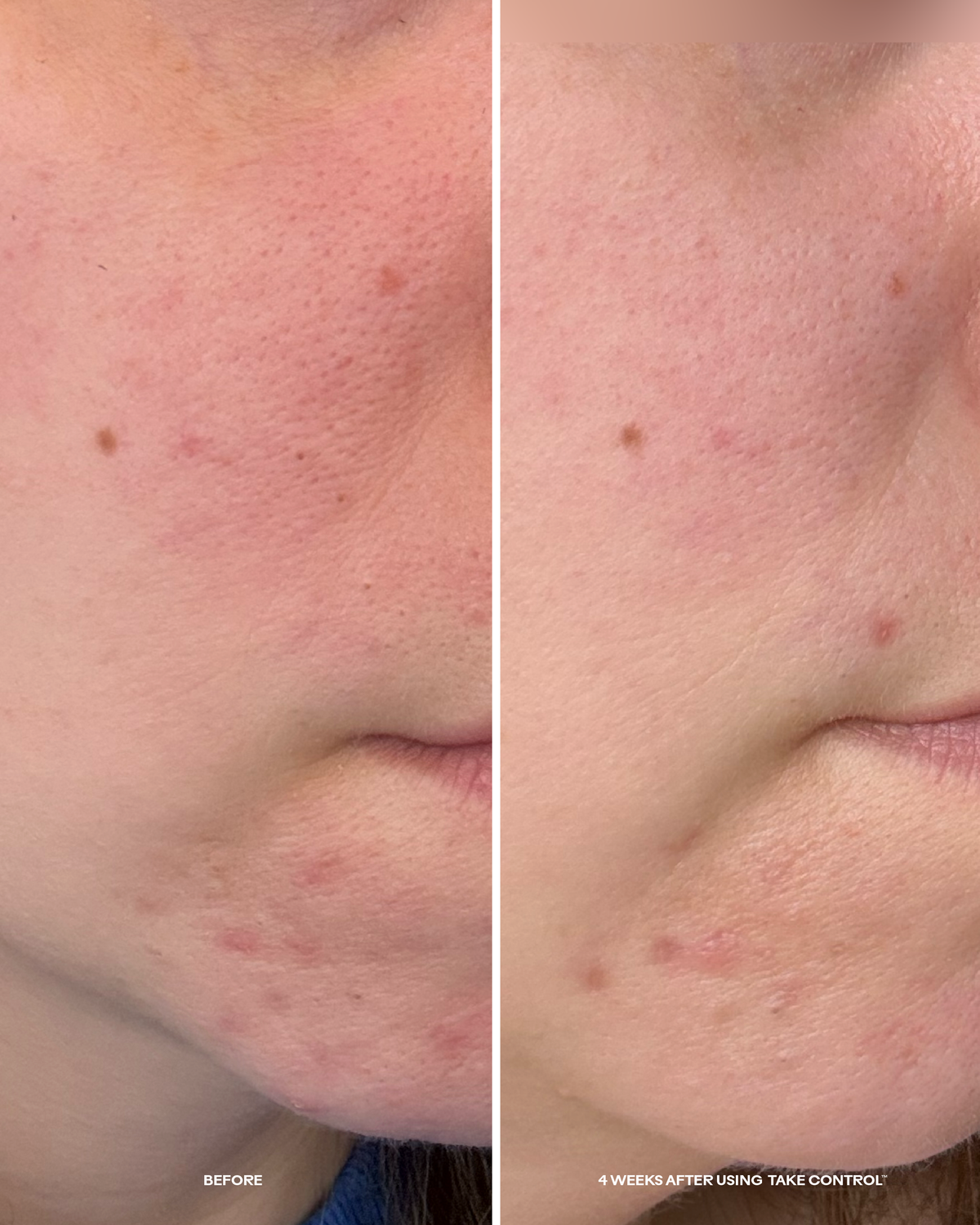 Three Ships - Take Control™ Salicylic + 10% Azelaic Acid Clarifying Serum