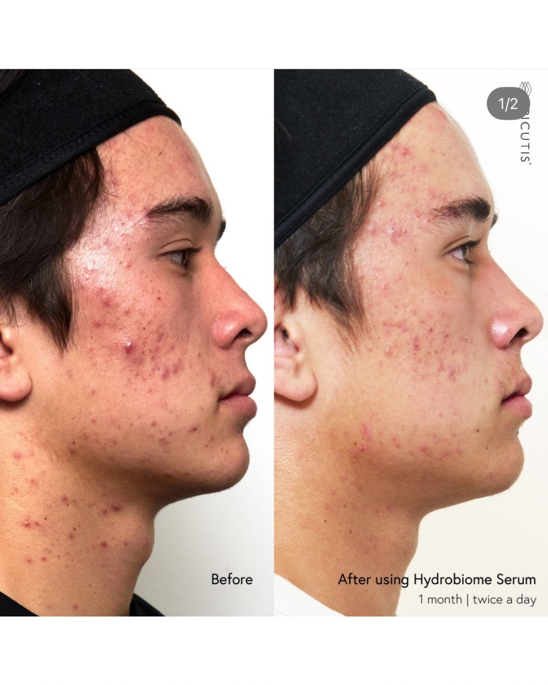 Epicutis Hydrobiome Serum (50ml)
