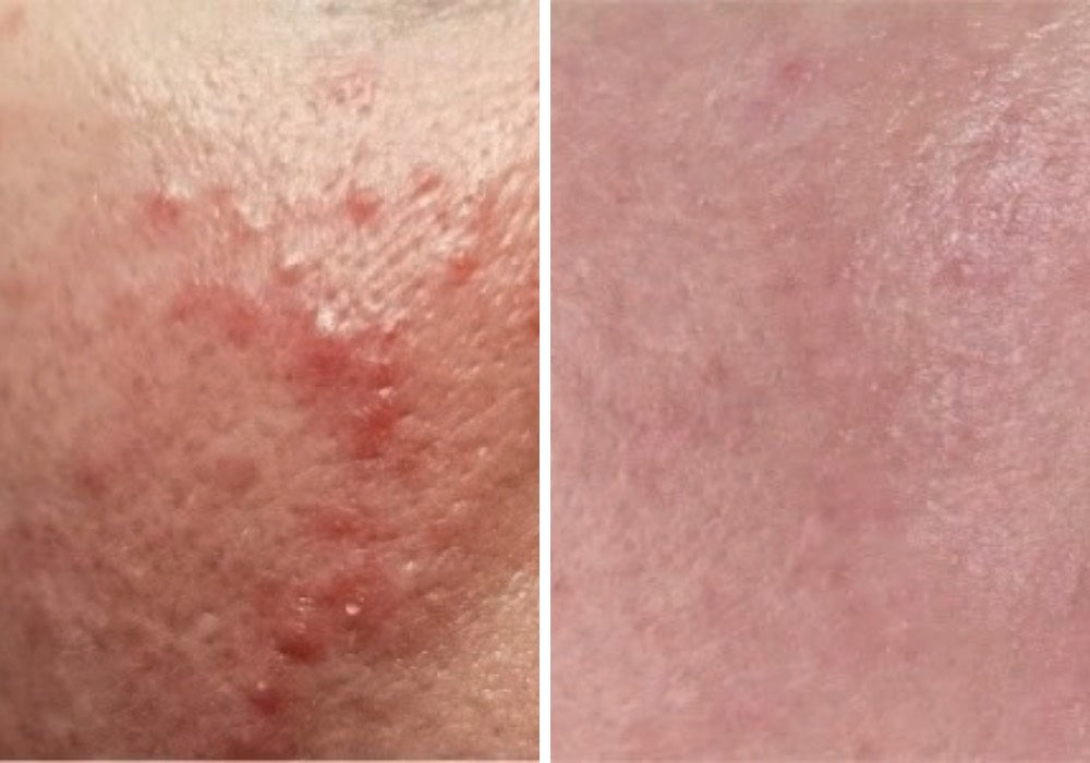 Three Ships - Restore Ceramides + Gotu Kola Barrier Repair Cream